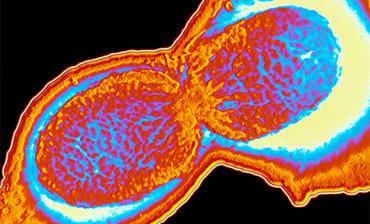 Nearly 1,700 British Tourists Sue TUI Over Illnesses in Cape Verde, Eight Deaths Reported 2 Travel & Tourism News – Global, Trusted, Independent Shigellosis H | eTurboNews | eTN