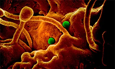 MERS-CoV particles on camel epithelial cells. Credit: NIAID