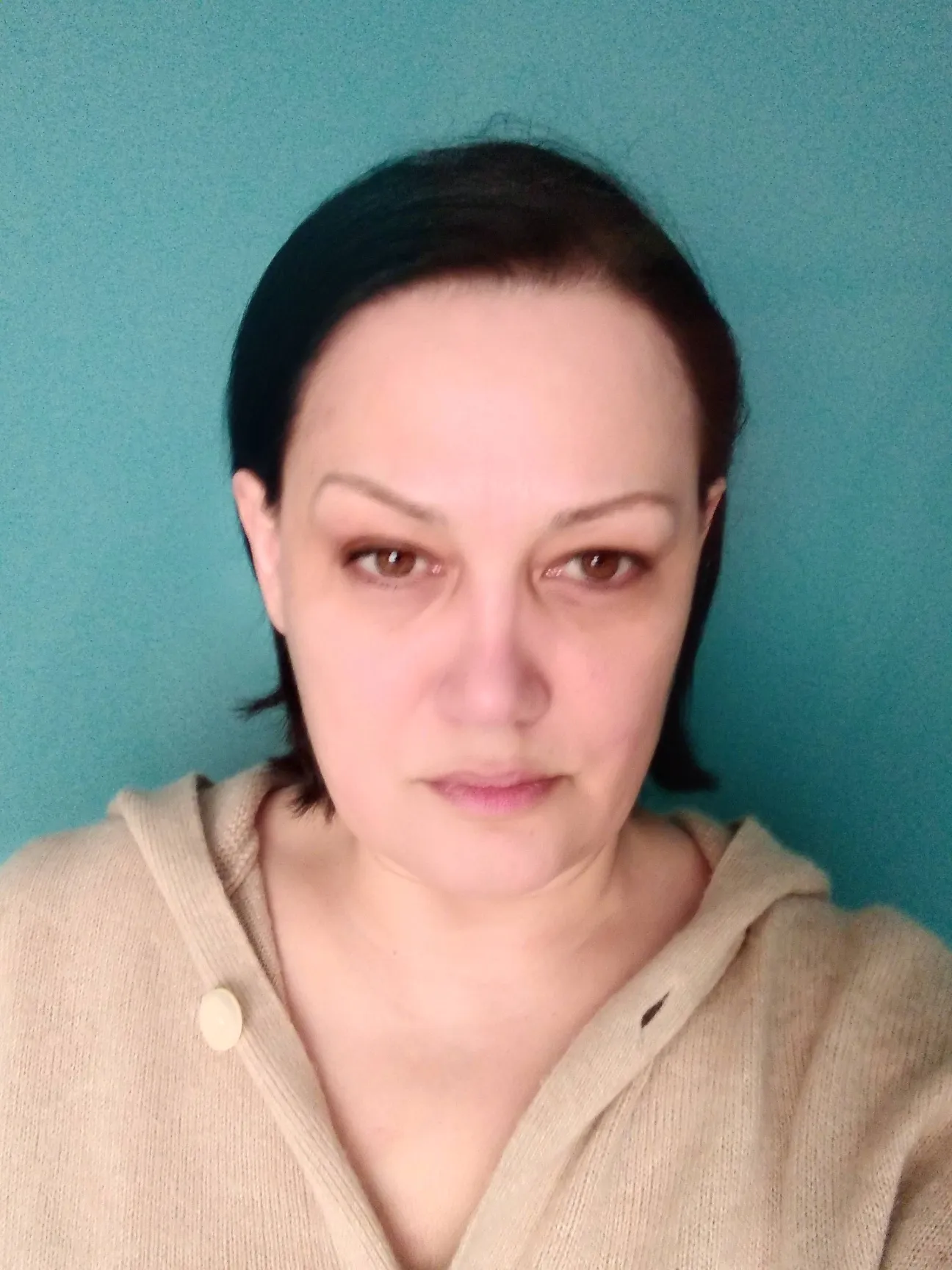 Dr. Nataliie Halushko,  Head of the Department of Epidemiological Surveillance and Prevention of Infectious Diseases at the Sumy Regional Center for Disease Control and Prevention