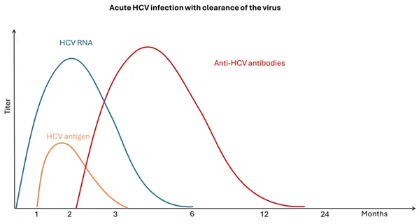 Acute HCV infection with clearance of the virus