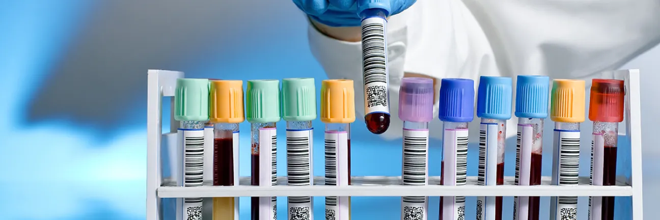 Blood. ©Istock