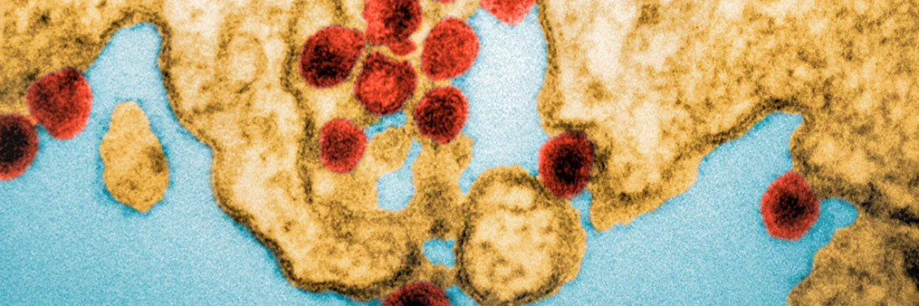 Chikungunya virus particles. © Science Photo Library