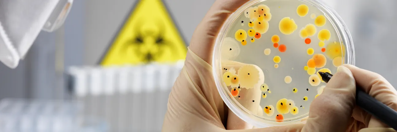 Bacteria in Petri dish. © Istock