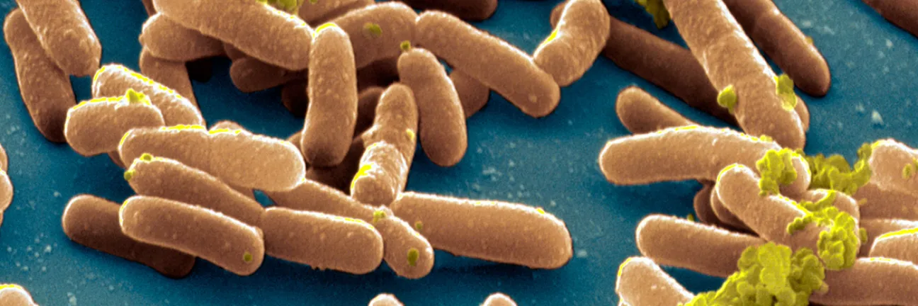 Salmonella typhimurium bacteria. © Science Photo Library
