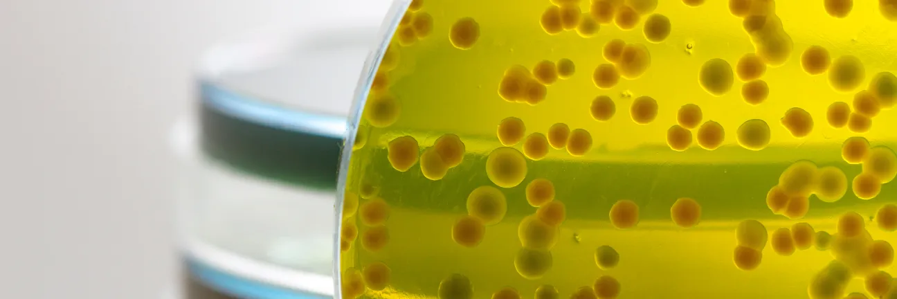 Shigella testing