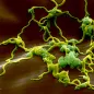 Lyme disease bacteria, Borrelia. © Science Photo Library