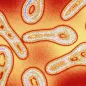 Coloured TEM of Corynebacterium bacteria. © Science Photo Library