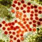 Hepatitis A virus particles, TEM. © Science Photo Library