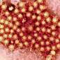 Hepatitis virus particles, TEM. © Science Photo Library