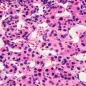 Hepatitis virus particles, TEM. © Science Photo Library