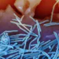 RSV virus 