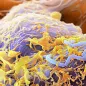 Listeria bacteria, SEM. © Science Photo Library