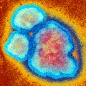 Measles virus particles, TEM. © Science Photo Library