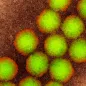 Poliovirus particles, TEM. © Science Photo Library