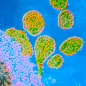 TEM of Rubella viruses. © Science Photo Library