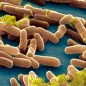 Salmonella typhimurium bacteria. © Science Photo Library