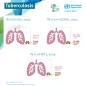 Tuberculosis cases, 2023