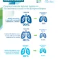 Infographic: Tuberculosis treatment outcomes in the European Region, 2022