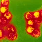 Coloured TEM of tick-borne encephalitis virus. © Science Photo Library