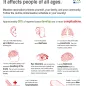 Measles infographic