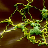 Lyme disease bacteria, Borrelia. © Science Photo Library