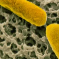 Clostridium botulinum bacteria. © Science Photo Library