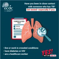 Have you been in close contact with someone who has TB?