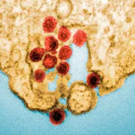 Chikungunya virus particles. © Science Photo Library