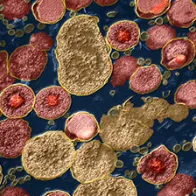 Chlamydia trachomatis bacteria, TEM. © Science Photo Library