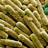 Clostridium difficile bacteria, SEM. © Science Photo Library