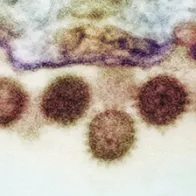Crimean-Congo haemorrhagic fever virus. © Science Photo Library