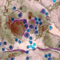 Dengue fever virus particles, TEM. © Science Photo Library