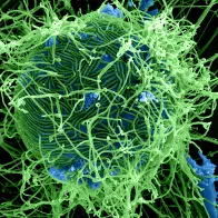 Ebola Virus Particles 4 by NIAID.jpg