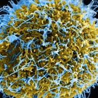 Ebola virus particles. Credit: NIAID