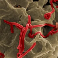 Scanning electron micrograph of Ebola virus budding from the surface of a Vero cell (African green monkey kidney epithelial cell line). Credit: NIAID