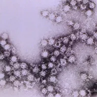 Morphologic traits of the Coxsackie B4 virus virions. Credit: CDC