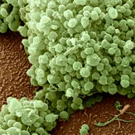 Gonorrhoea bacteria, SEM. © Science Photo Library