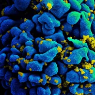 HIV-infected H9 T Cell. Credit: NIAID
