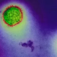 Hantavirus. © Science Photo Library