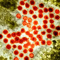 Hepatitis A virus particles, TEM. © Science Photo Library