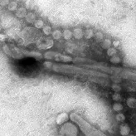 Influenza A (H7N9) virus. Credit: CDC/Cynthia S. Goldsmith and Thomas Rowe