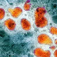 H5N1 avian influenza virus particles, TEM. © Science Photo Library