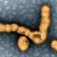 H1N1 Influenza virus particles. Credit: NIAID