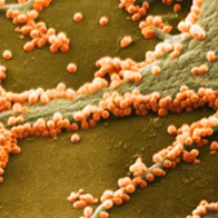 H1N1 flu virus particles, SEM. © Science Photo Library