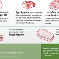 Infographic - Measles is a serious disease