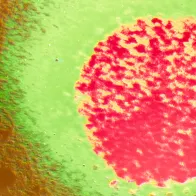 Coloured TEM of Lassa fever virus. © Science Photo Library