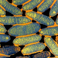 TEM of Legionella pneumophila bacteria. © Science Photo Library
