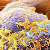 Listeria bacteria, SEM. © Science Photo Library