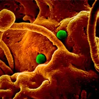 MERS-CoV particles on camel epithelial cells. Credit: NIAID