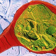 TEM of blood cell with malaria. © Science Photo Library